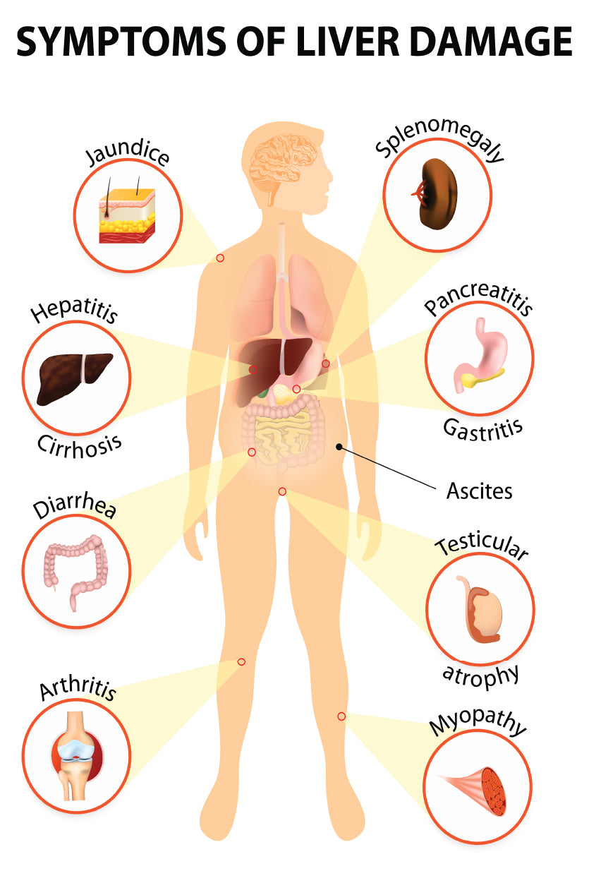 Symptoms Of Liver Disease Home Decor Premium Quality Poster Print Choose Your Sizes - Bella Home Decor