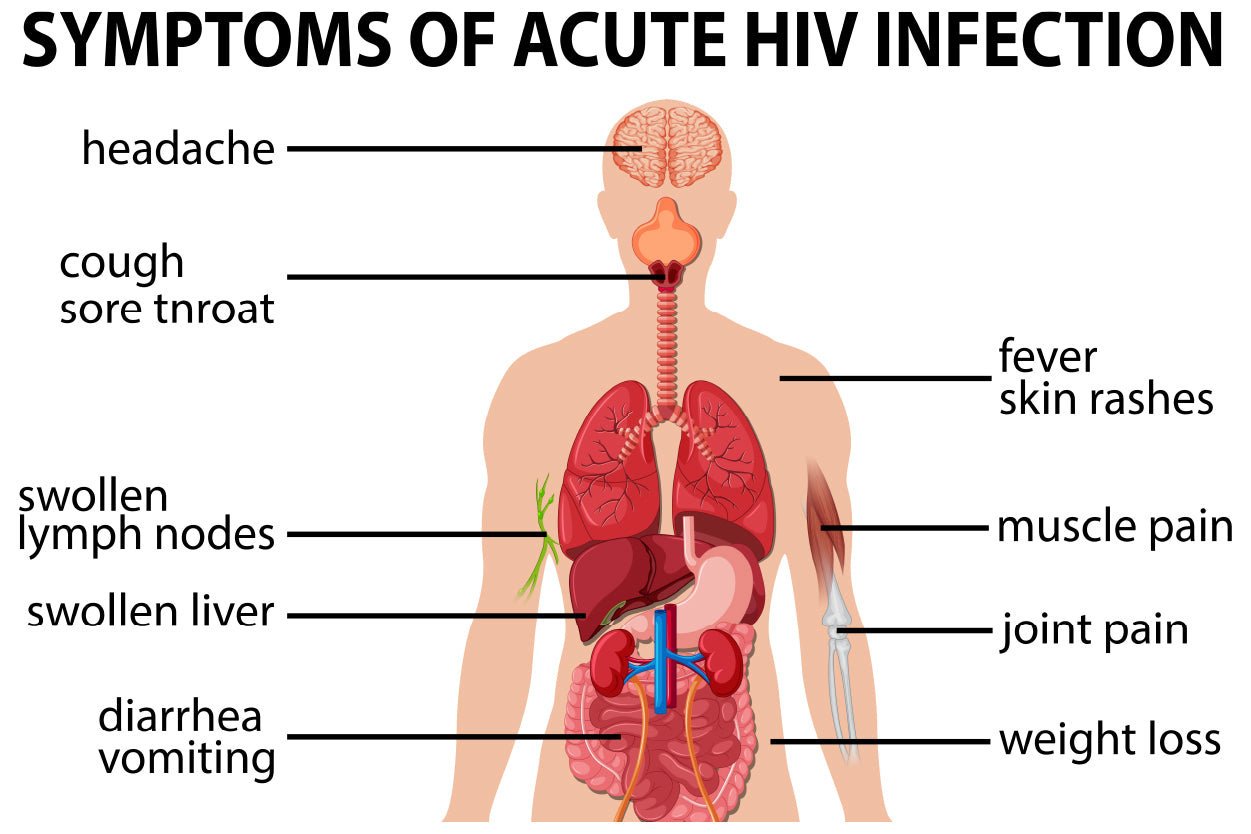 Chart Of Symptoms of Acute HIV Infection Home Decor Premium Quality Poster Print Choose Your Sizes - Bella Home Decor