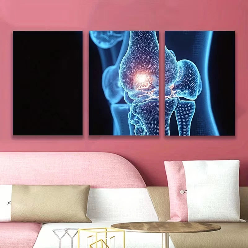 3pcs Skeleton And Joints Metal Print Ready to Hang Art