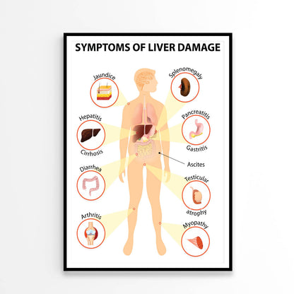 Symptoms Of Liver Disease Home Decor Premium Quality Poster Print Choose Your Sizes