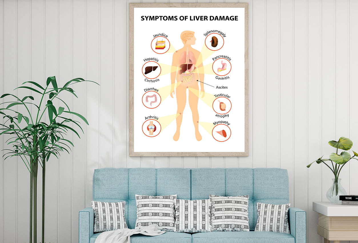 Symptoms Of Liver Disease Home Decor Premium Quality Poster Print Choose Your Sizes