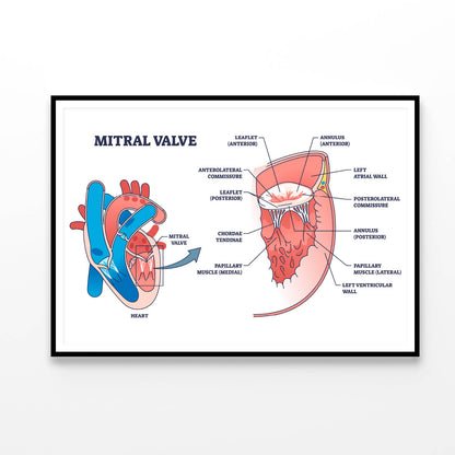 Mitral Valve Structure Home Decor Premium Quality Poster Print Choose Your Sizes