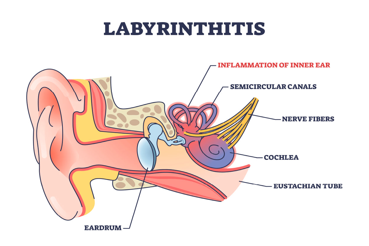 Labyrinthitis As Inner Ear Infection Diagram Home Decor Premium Quality Poster Print Choose Your Sizes