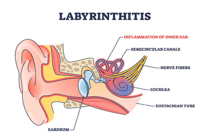 Labyrinthitis As Inner Ear Infection Diagram Home Decor Premium Quality Poster Print Choose Your Sizes